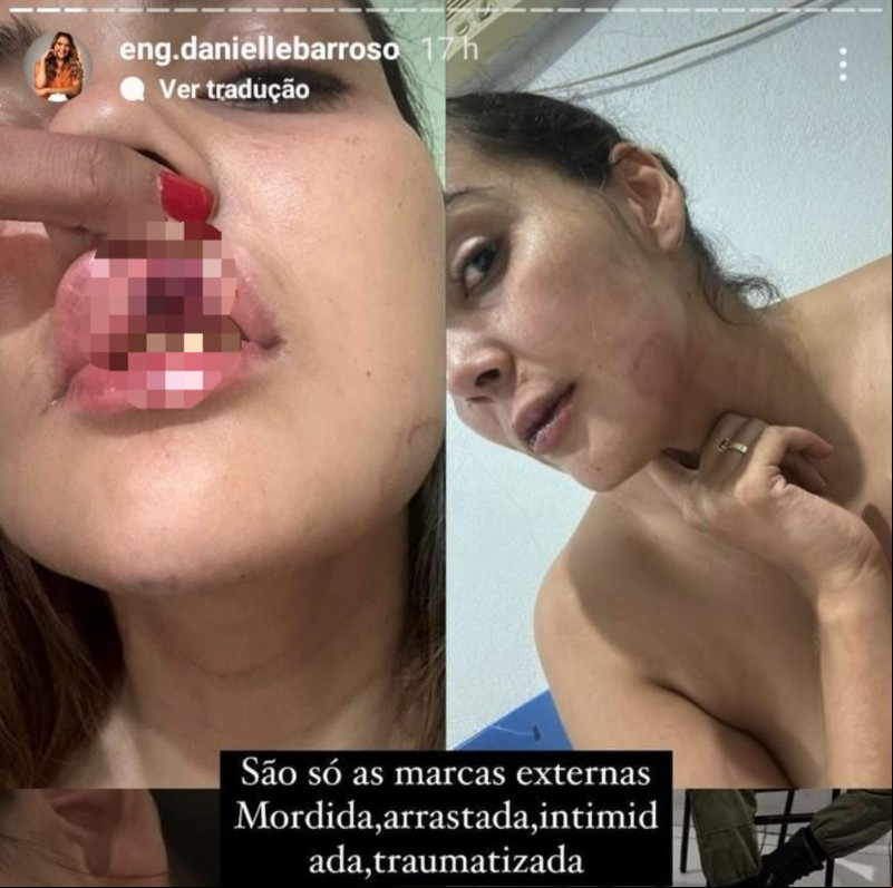 Acusado de agredir engenheira em Pedro II é solto pela Justiça