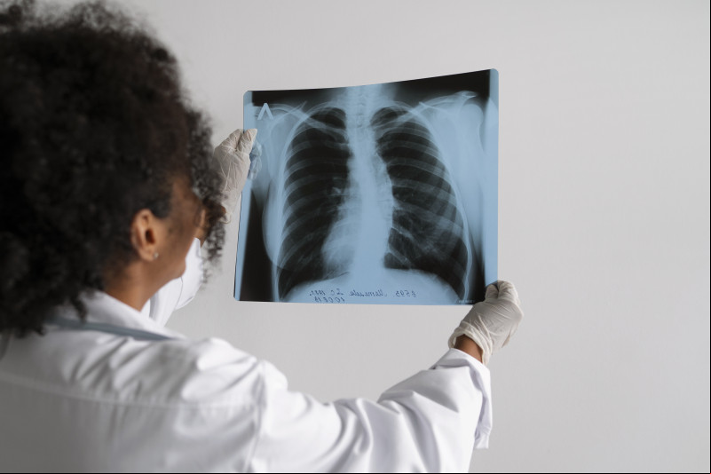 A pessoa com tuberculose precisa ser avaliada, ter um diagnóstico laboratorial e iniciar o tratamento o quanto antes - (Reprodução/Freepik)