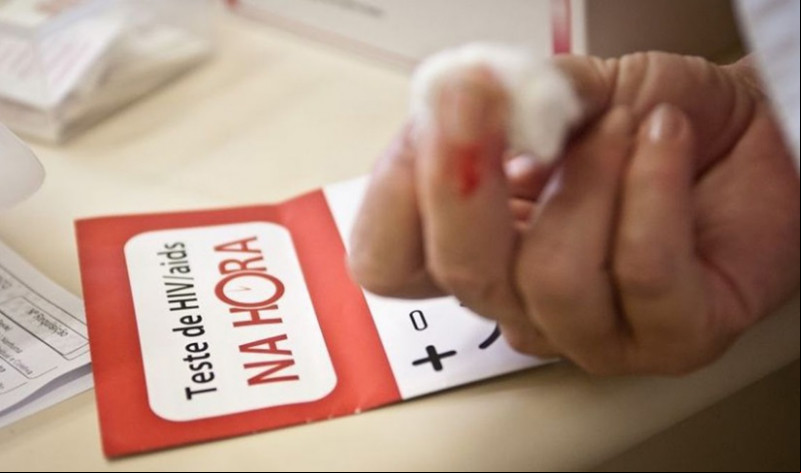 No Piauí, casos de HIV/Aids é maior entre jovens de 15 a 25 anos