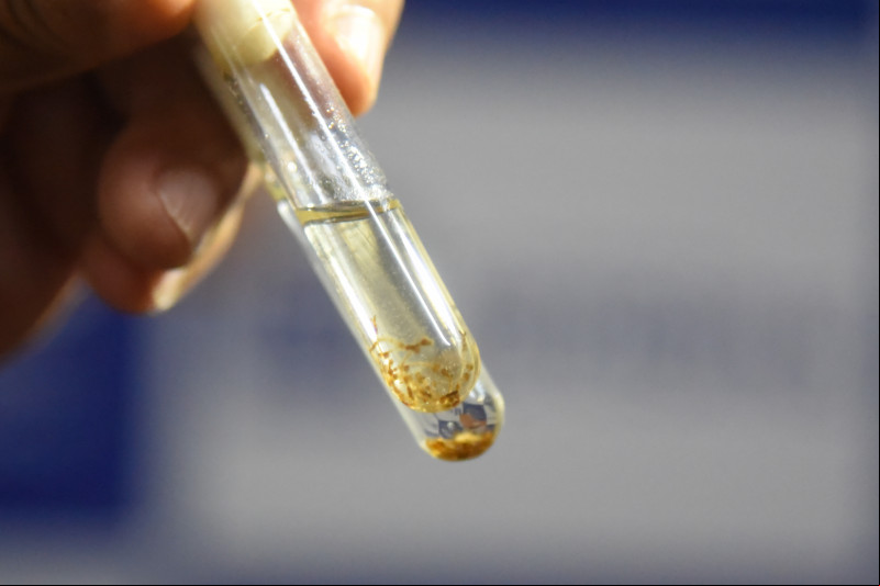FMS confirma primeiro óbito por dengue em Teresina em 2025